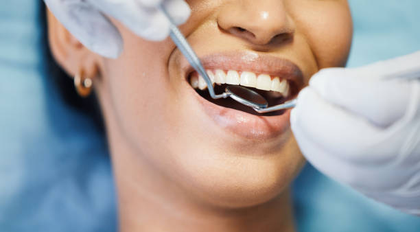 Best Broken or Chipped Tooth Repair in Spencerville, MD