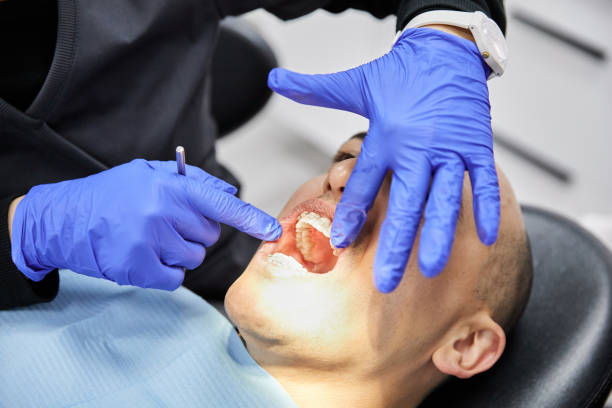 Best Emergency Wisdom Tooth Extraction in Spencerville, MD